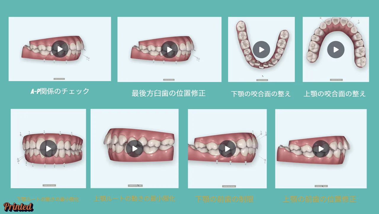 実習で扱う歯の動きのクリップ一覧